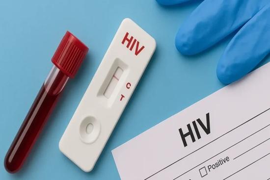 تغییر الگوی انتقال HIV در ایران از سرنگ مشترک به روابط جنسی پرخطر